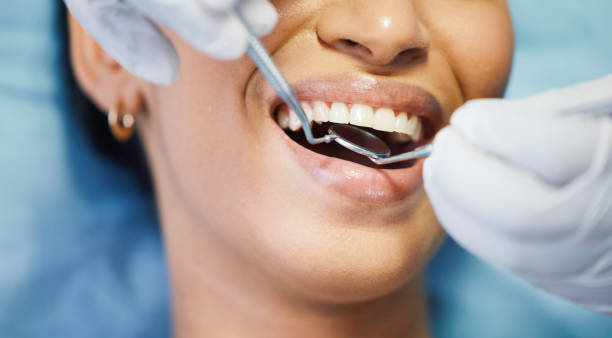 Best Emergency Treatment for Dental Infections or Abscesses in Tangerine, FL